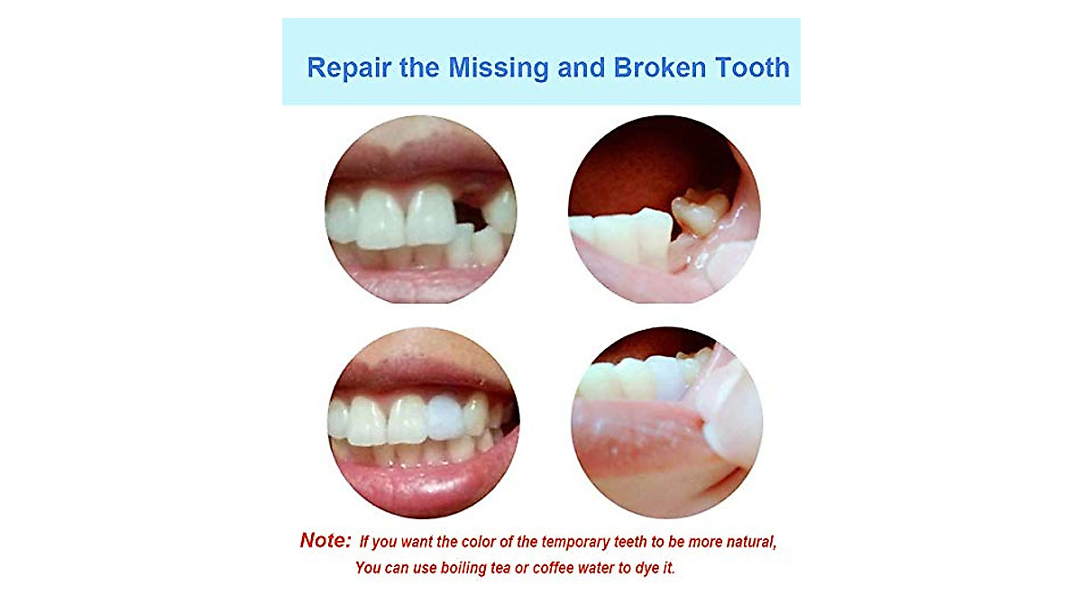 DIY Tooth Filling Thermal Beads - Temporary Tooth Repair