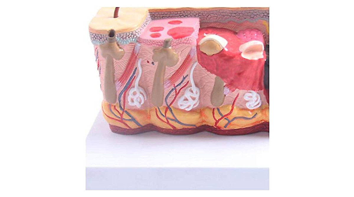 Human Burn Skin Anatomy Model for Medical Education