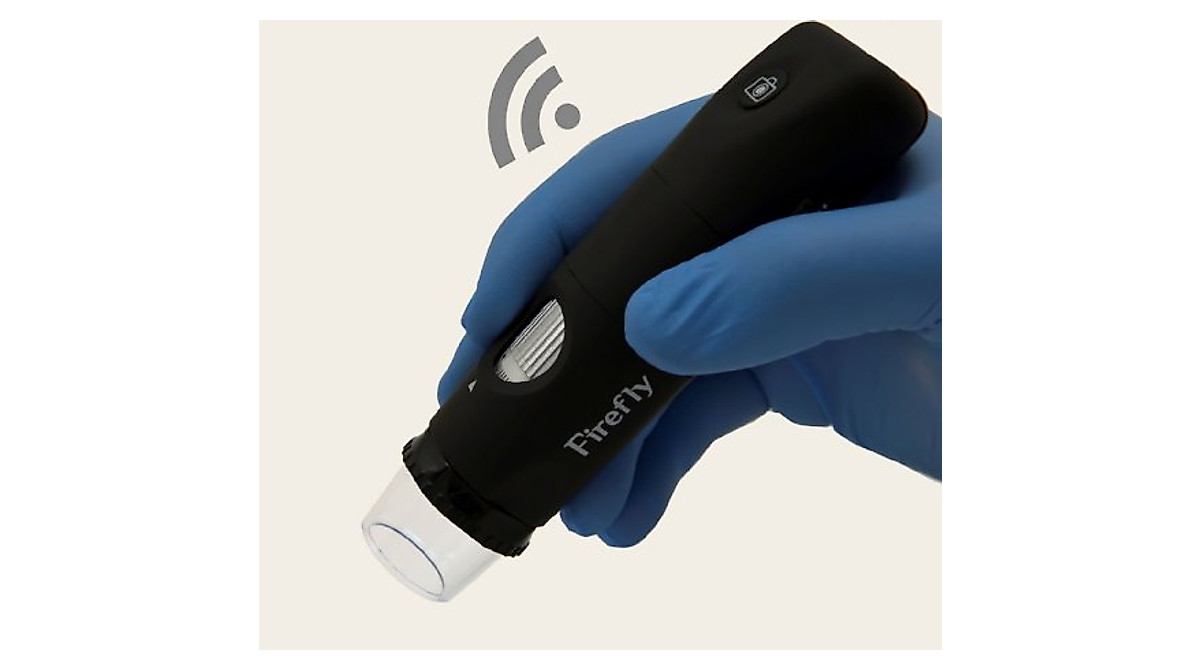 Firefly DE350 Wireless Polarizing Dermatoscope – High-Quality Skin Imaging