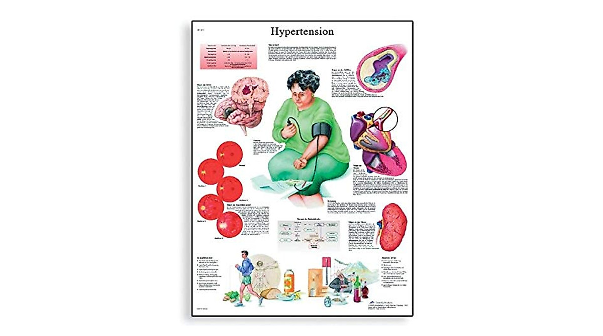Hypertension Anatomical Chart - 3B Scientific Poster