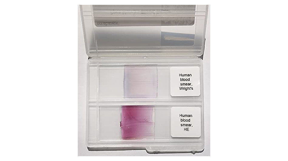 Human Blood Smear Slides for Microscopy - 2 Pack