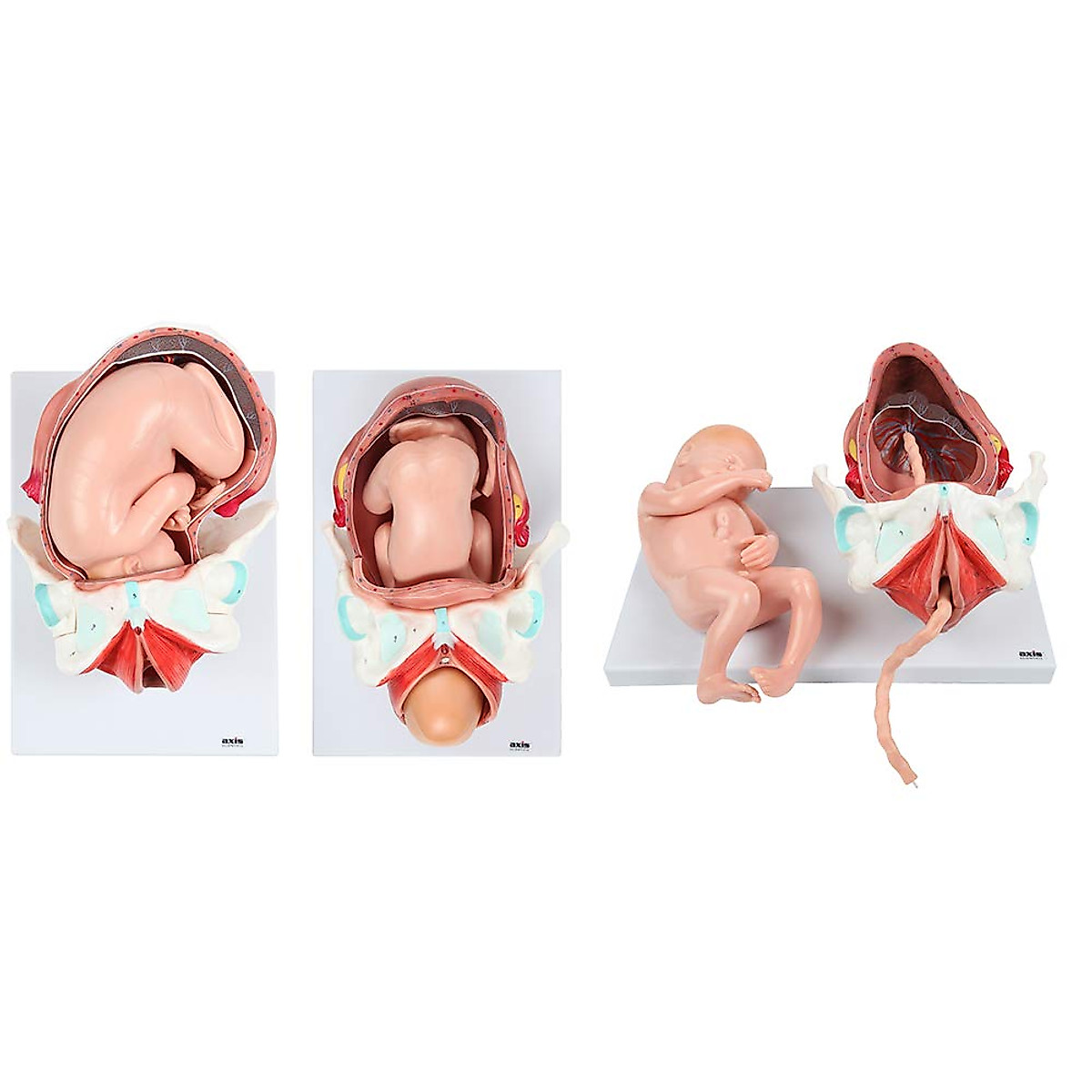 Childbirth Process Anatomical Model - 3 Stages for Education ...