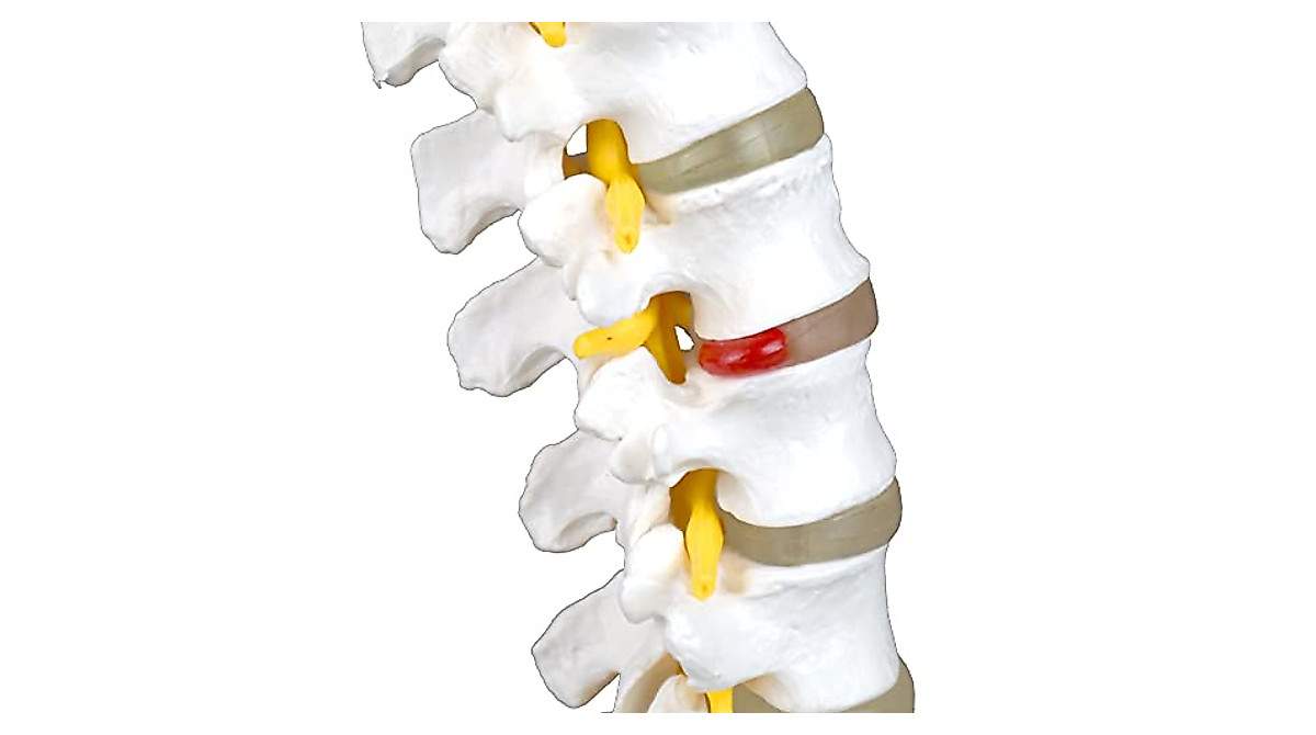 Vision Scientific Articulated Lumbar Spinal Column