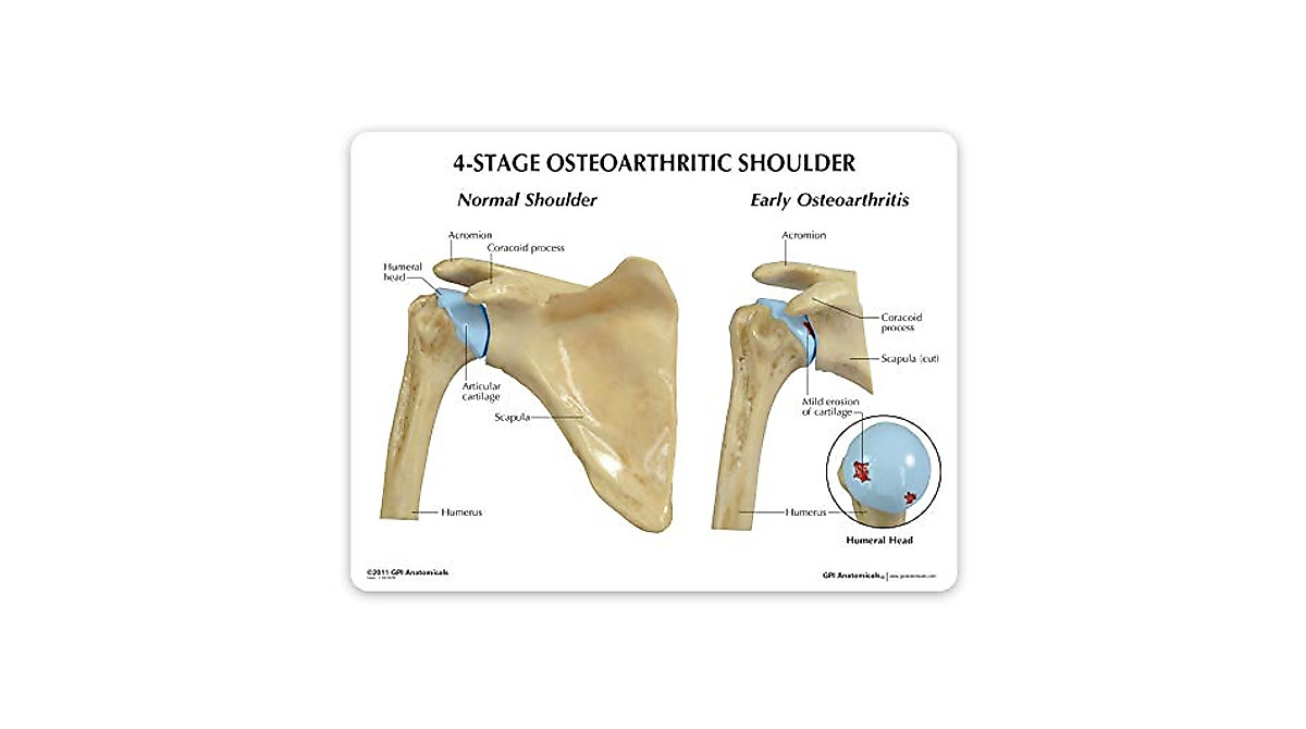 GPI Anatomicals Shoulder Joint Model | Patient Education Tool
