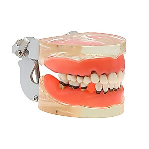 thumbnail image 2 of Dental Typodont Model With Removable Teeth 32 Teeth Model For Dental 2 of 13