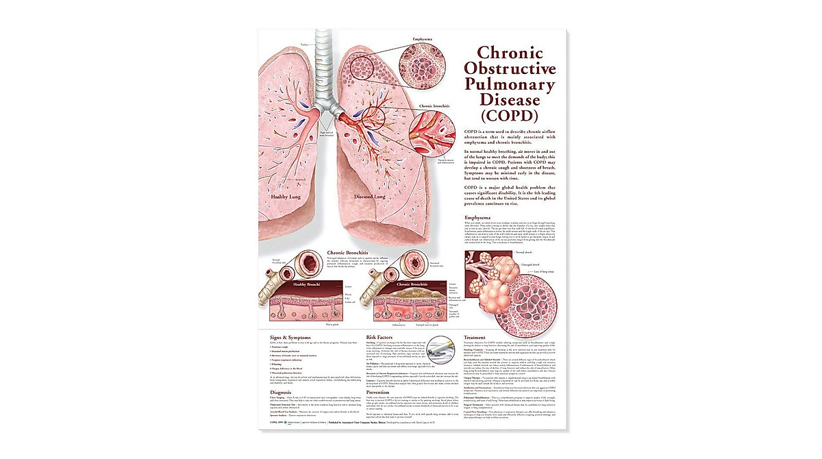 COPD Anatomical Chart for Medical Professionals & Educators