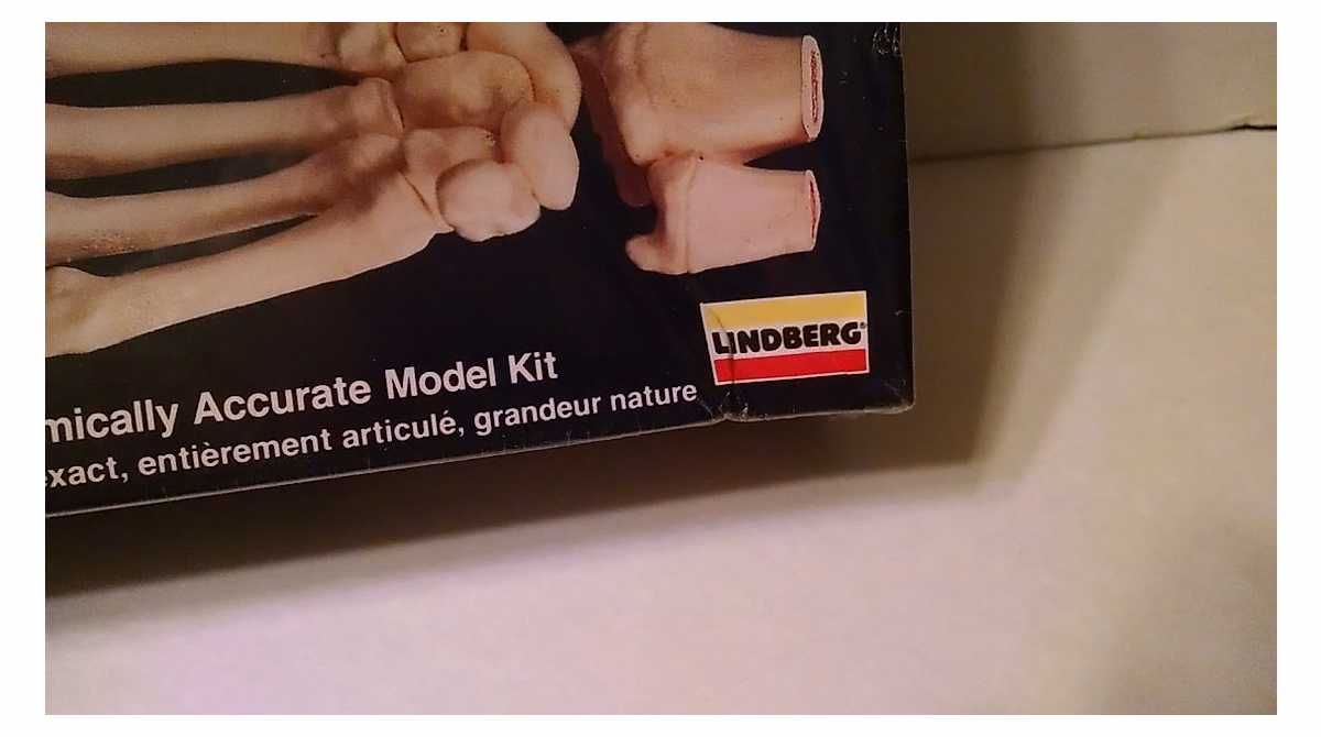 Lindberg Skeletal Hand - Life-Size Anatomical Model for Education