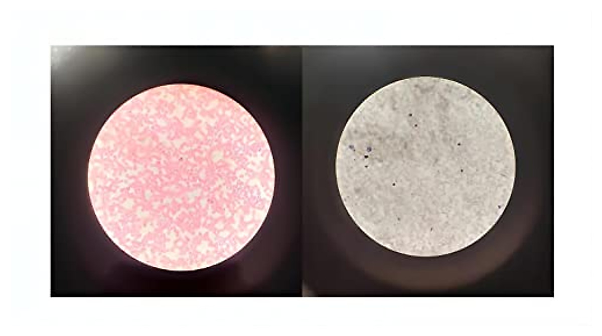 Human Blood Smear Slides for Microscopy - 2 Pack
