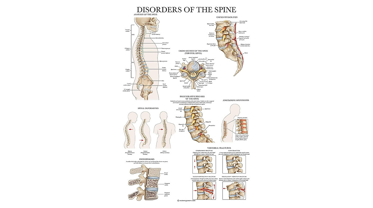 Palace Learning Spine Anatomy Poster - Laminated Spinal Chart | 18x24