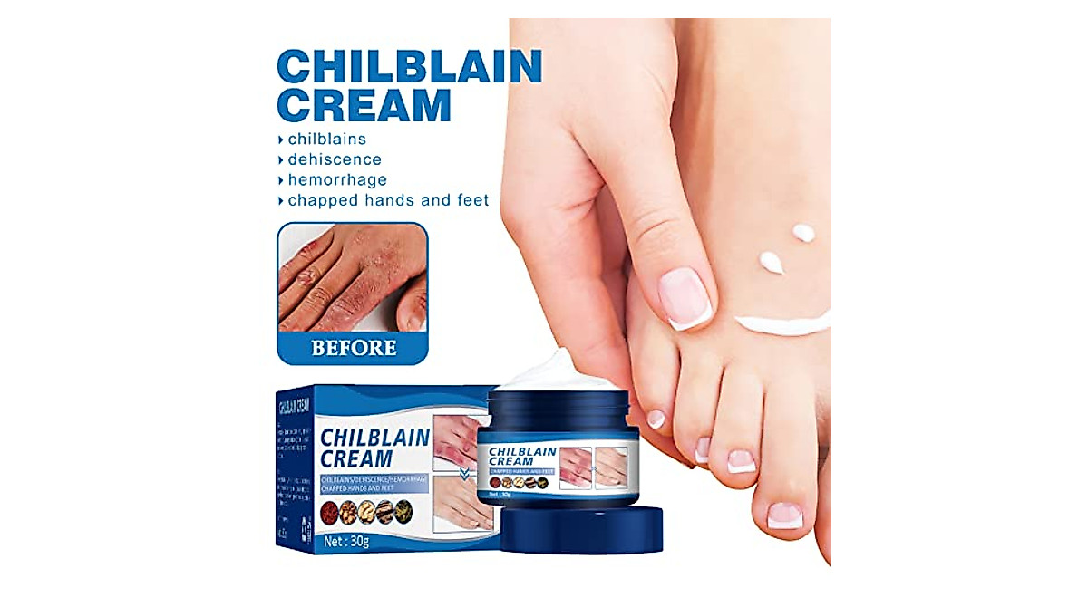 LONGLUAN Chilblain Cream - Deep Moisturizer for Cracked Skin