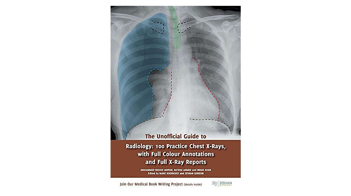 Practice Chest X-Rays: The Unofficial Guide for Radiology