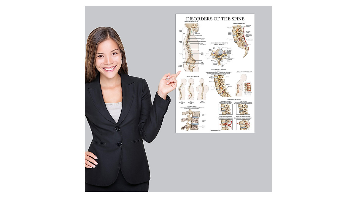 Palace Learning Spine Anatomy Poster - Laminated Spinal Chart | 18x24